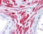 STAT5B antibody - middle region